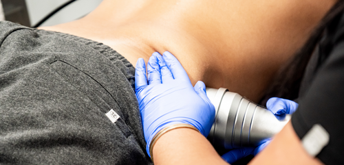 Body Contouring Package