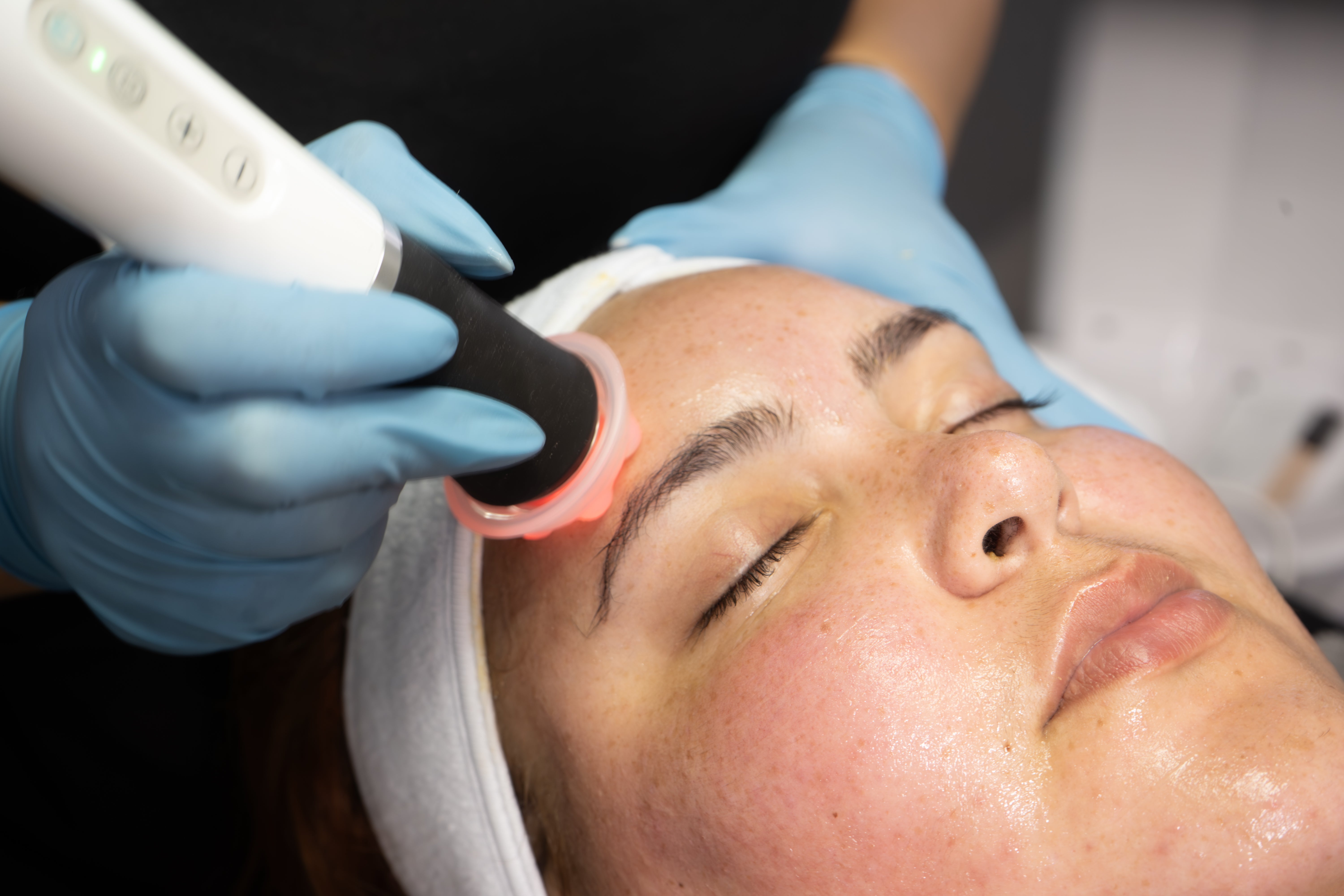 Med Spa in Kissimmee | Botox, Laser & Brazilian Wax | Nature's Wax